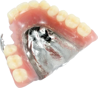 精密金属床義歯